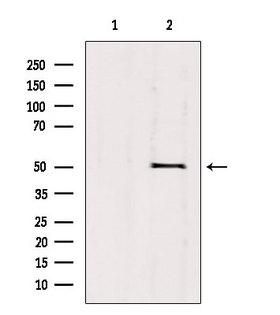 VANGL1 Antibody - Western blot analysis of extracts of 293 cells using VANGL1 antibody. Lane 1 was treated with the blocking peptide.