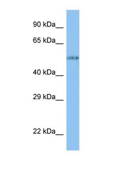 VANGL1 Antibody - VANGL1 antibody Western blot of 8226 Cell lysate. Antibody concentration 1 ug/ml.  This image was taken for the unconjugated form of this product. Other forms have not been tested.