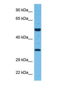 VANGL1 Antibody - Western blot of VANG1 Antibody with human OVCAR-3 Whole Cell lysate.  This image was taken for the unconjugated form of this product. Other forms have not been tested.