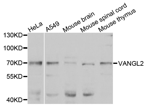VANGL2 / LTAP Antibody - Western blot analysis of extracts of various cells.