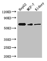 VANGL2 / LTAP Antibody - Western Blot Positive WB detected in:HepG2 whole cell lysate,MCF-7 whole cell lysate,Mouse kidney tissue All Lanes: Vangl2 antibody at 3ug/ml Secondary Goat polyclonal to rabbit IgG at 1/50000 dilution Predicted band size: 60 kDa Observed band size: 60 kDa