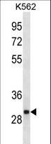 VAP33 / VAPA Antibody - VAPA Antibody western blot of K562 cell line lysates (35 ug/lane). The VAPA antibody detected the VAPA protein (arrow).