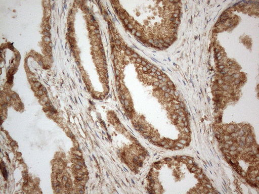 VAP33 / VAPA Antibody - Immunohistochemical staining of paraffin-embedded Human prostate tissue within the normal limits using anti-VAPA mouse monoclonal antibody. (Heat-induced epitope retrieval by 1mM EDTA in 10mM Tris buffer. (pH8.5) at 120°C for 3 min. (1:150)