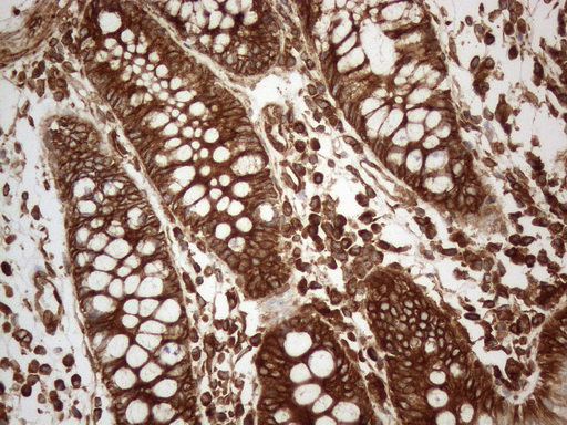 VAP33 / VAPA Antibody - Immunohistochemical staining of paraffin-embedded Human colon tissue within the normal limits using anti-VAPA mouse monoclonal antibody. (Heat-induced epitope retrieval by 1mM EDTA in 10mM Tris buffer. (pH8.5) at 120°C for 3 min. (1:150)