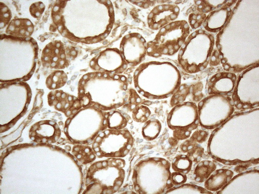 VAP33 / VAPA Antibody - Immunohistochemical staining of paraffin-embedded Human thyroid tissue within the normal limits using anti-VAPA mouse monoclonal antibody. (Heat-induced epitope retrieval by 1mM EDTA in 10mM Tris buffer. (pH8.5) at 120°C for 3 min. (1:150)