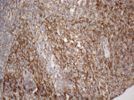 VAP33 / VAPA Antibody - Immunohistochemical staining of paraffin-embedded Human tonsil within the normal limits using anti-VAPA mouse monoclonal antibody. (Heat-induced epitope retrieval by 1mM EDTA in 10mM Tris buffer. (pH8.5) at 120°C for 3 min. (1:150)