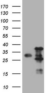 VAP33 / VAPA Antibody - HEK293T cells were transfected with the pCMV6-ENTRY control. (Left lane) or pCMV6-ENTRY VAPA. (Right lane) cDNA for 48 hrs and lysed