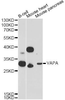 VAP33 / VAPA Antibody - Western blot analysis of extracts of various cell lines, using VAPA Antibody at 1:3000 dilution. The secondary antibody used was an HRP Goat Anti-Rabbit IgG (H+L) at 1:10000 dilution. Lysates were loaded 25ug per lane and 3% nonfat dry milk in TBST was used for blocking. An ECL Kit was used for detection and the exposure time was 90s.