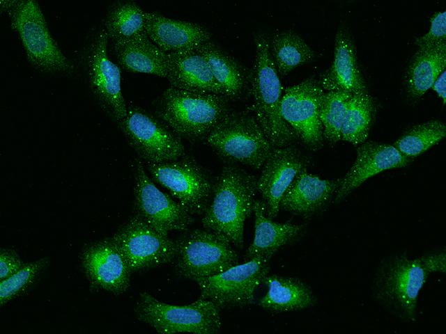VAP33 / VAPA Antibody - Immunofluorescence staining of VAPA in U2OS cells. Cells were fixed with 4% PFA, permeabilzed with 0.1% Triton X-100 in PBS, blocked with 10% serum, and incubated with rabbit anti-Human VAPA polyclonal antibody (dilution ratio 1:200) at 4°C overnight. Then cells were stained with the Alexa Fluor 488-conjugated Goat Anti-rabbit IgG secondary antibody (green) and counterstained with DAPI (blue). Positive staining was localized to Cytoplasm.
