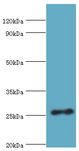 VAPB Antibody - Western blot. All lanes: Vesicle-associated membrane protein-associated protein B/C antibody at 3 ug/ml+mouse brain tissue. Secondary antibody: Goat polyclonal to rabbit at 1:10000 dilution. Predicted band size: 27 kDa. Observed band size: 27 kDa.