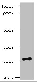 VAPB Antibody - Western blot All lanes: Vesicle-associated membrane protein-associated protein B/C antibody at 3µg/ml + Mouse brain tissue Secondary Goat polyclonal to rabbit IgG at 1/10000 dilution Predicted band size: 28, 12 kDa Observed band size: 28 kDa