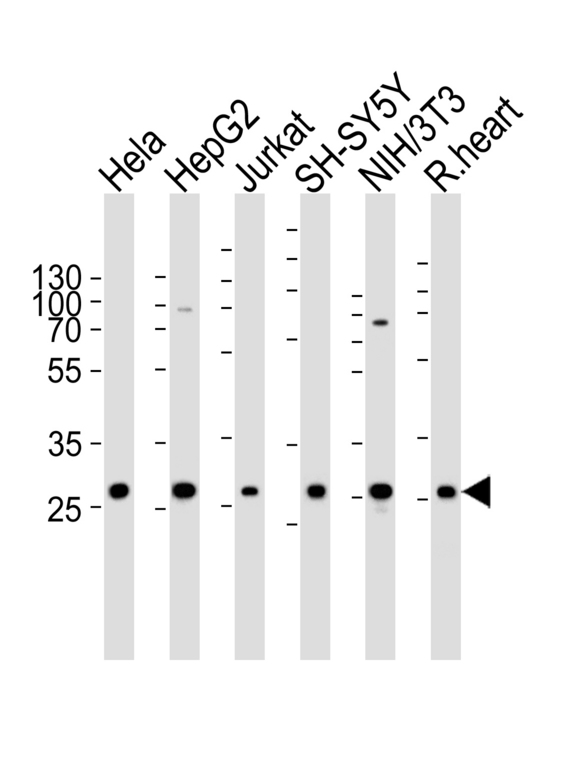 VAPB Antibody - Western blot of lysates from HeLa, HepG2, Jurkat, SH-SY5Y, mouse NIH/3T3 cell line and rat heart tissue lysate (from left to right) with VAPB Antibody. Antibody was diluted at 1:1000 at each lane. A goat anti-rabbit IgG H&L (HRP) at 1:5000 dilution was used as the secondary antibody. Lysates at 35 ug per lane.