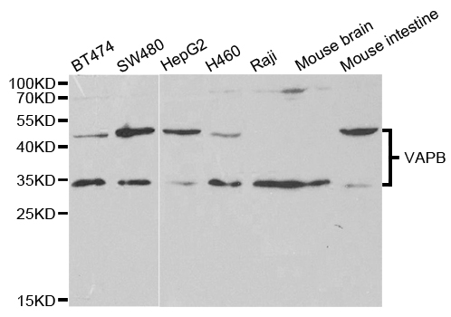 VAPB Antibody - Western blot analysis of extracts of various cell lines.