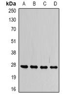 VAPB Antibody - Western blot analysis of VAP-B/C expression in SW480 (A); HepG2 (B); Raji (C); mouse brain (D) whole cell lysates.