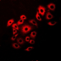 VAPB Antibody - Immunofluorescent analysis of VAP-B/C staining in HeLa cells. Formalin-fixed cells were permeabilized with 0.1% Triton X-100 in TBS for 5-10 minutes and blocked with 3% BSA-PBS for 30 minutes at room temperature. Cells were probed with the primary antibody in 3% BSA-PBS and incubated overnight at 4 deg C in a humidified chamber. Cells were washed with PBST and incubated with a DyLight 594-conjugated secondary antibody (red) in PBS at room temperature in the dark.
