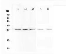 VAPB Antibody - Western blot - Anti-VAPB antibody