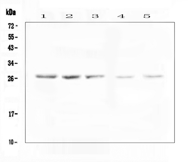 VAPB Antibody - Western blot analysis of VAPB using anti-VAPB antibody. Electrophoresis was performed on a 5-20% SDS-PAGE gel at 70V (Stacking gel) / 90V (Resolving gel) for 2-3 hours. The sample well of each lane was loaded with 50ug of sample under reducing conditions. Lane 1: human PANC-1 whole cell lysates, Lane 2: human SGC-7901 whole cell lysates, Lane 3: human A549 whole cell lysates, Lane 4: rat testis tissue lysates,Lane 5: mouse testis tissue lysates. After Electrophoresis, proteins were transferred to a Nitrocellulose membrane at 150mA for 50-90 minutes. Blocked the membrane with 5% Non-fat Milk/ TBS for 1.5 hour at RT. The membrane was incubated with rabbit anti-VAPB antigen affinity purified polyclonal antibody at 0.5 µg/mL overnight at 4°C, then washed with TBS-0.1% Tween 3 times with 5 minutes each and probed with a goat anti-rabbit IgG-HRP secondary antibody at a dilution of 1:10000 for 1.5 hour at RT. The signal is developed using an Enhanced Chemiluminescent detection (ECL) kit with Tanon 5200 system. A specific band was detected for VAPB at approximately 27KD. The expected band size for VAPB is at 27KD.