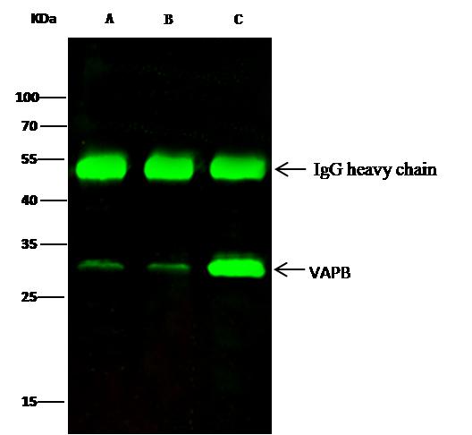 VAPB Antibody - VAPB was immunoprecipitated using: Lane A: 0.5 mg HepG2 Whole Cell Lysate. Lane B: 0.5 mg Jurkat Whole Cell Lysate. Lane C:0.5 mg A549 Whole Cell Lysate. 2 uL anti-VAPB rabbit polyclonal antibody and 15 ul of 50% Protein G agarose. Primary antibody: Anti-VAPB rabbit polyclonal antibody, at 1:200 dilution. Secondary antibody: Dylight 800-labeled antibody to rabbit IgG (H+L), at 1:5000 dilution. Developed using the odssey technique. Performed under reducing conditions. Predicted band size: 27 kDa. Observed band size: 27 kDa.