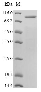 Varicella Zoster Virus (VZV) Glycoprotein E (gE) Protein - (Tris-Glycine gel) Discontinuous SDS-PAGE (reduced) with 5% enrichment gel and 15% separation gel.