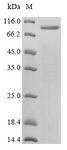 Varicella Zoster Virus (VZV) Glycoprotein E (gE) Protein - (Tris-Glycine gel) Discontinuous SDS-PAGE (reduced) with 5% enrichment gel and 15% separation gel.