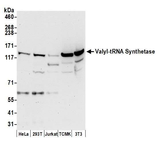 VARS / ValRS Antibody - Detection of human and mouse Valyl-tRNA Synthetase/VARS by western blot. Samples: Whole cell lysate (50 µg) from HeLa, HEK293T, Jurkat, mouse TCMK-1, and mouse NIH 3T3 cells prepared using NETN lysis buffer. Antibody: Affinity purified rabbit anti-Valyl-tRNA Synthetase/VARS antibody used for WB at 0.1 µg/ml. Detection: Chemiluminescence with an exposure time of 30 seconds.