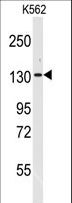 VARS / ValRS Antibody - Western blot of anti-VARS Antibody in K562 cell line lysates (35 ug/lane). VARS (arrow) was detected using the purified antibody.