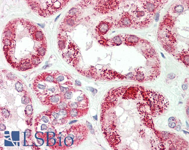 VARS / ValRS Antibody - Human, Kidney: Formalin-Fixed Paraffin-Embedded (FFPE).  This image was taken for the unconjugated form of this product. Other forms have not been tested.