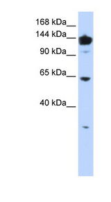 VARS / ValRS Antibody - VARS antibody Western blot of 721_B cell lysate.  This image was taken for the unconjugated form of this product. Other forms have not been tested.