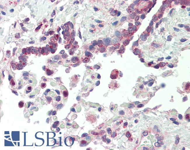 VARS / ValRS Antibody - Human, Lung: Formalin-Fixed Paraffin-Embedded (FFPE).  This image was taken for the unconjugated form of this product. Other forms have not been tested.