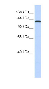 VARS / ValRS Antibody - VARS antibody Western blot of 721_B cell lysate. This image was taken for the unconjugated form of this product. Other forms have not been tested.