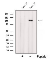 VARS / ValRS Antibody - Western blot analysis of extracts of Jurkat cells using VARS2 antibody. The lane on the left was treated with blocking peptide.
