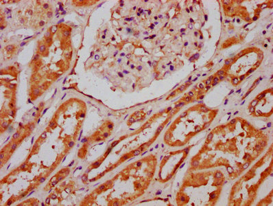VARS2 / ValRS Antibody - Immunohistochemistry Dilution at 1:300 and staining in paraffin-embedded human kidney tissue performed on a Leica BondTM system. After dewaxing and hydration, antigen retrieval was mediated by high pressure in a citrate buffer (pH 6.0). Section was blocked with 10% normal Goat serum 30min at RT. Then primary antibody (1% BSA) was incubated at 4°C overnight. The primary is detected by a biotinylated Secondary antibody and visualized using an HRP conjugated SP system.