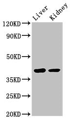 VASH2 Antibody - Western Blot Positive WB detected in:Mouse liver tissue,Mouse kidney tissue All Lanes:VASH2 antibody at 3µg/ml Secondary Goat polyclonal to rabbit IgG at 1/50000 dilution Predicted band size: 41,34,19,36,30 KDa Observed band size: 41 KDa