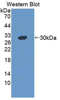 VASN / Vasorin Antibody - Western blot of VASN / Vasorin antibody.