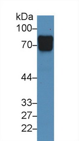 VASN / Vasorin Antibody - Western Blot; Sample: Human Urine; Primary Ab: 3µg/ml Rabbit Anti-Human VASN Antibody Second Ab: 0.2µg/mL HRP-Linked Caprine Anti-Rabbit IgG Polyclonal Antibody