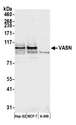 VASN / Vasorin Antibody - Detection of human VASN by western blot. Samples: Whole cell lysate (50 µg) from Hep-G2, MCF-7, and A-549 cells prepared using NETN lysis buffer. Antibody: Affinity purified rabbit anti-VASN antibody used for WB at 1:1000. Detection: Chemiluminescence with an exposure time of 10 seconds.