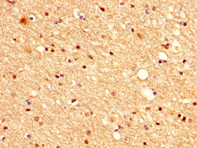 Vasohibin 1 / VASH1 Antibody - IHC image of VASH1 Antibody diluted at 1:500 and staining in paraffin-embedded human brain tissue performed on a Leica BondTM system. After dewaxing and hydration, antigen retrieval was mediated by high pressure in a citrate buffer (pH 6.0). Section was blocked with 10% normal goat serum 30min at RT. Then primary antibody (1% BSA) was incubated at 4°C overnight. The primary is detected by a biotinylated secondary antibody and visualized using an HRP conjugated SP system.