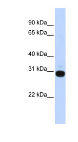 Vasohibin 1 / VASH1 Antibody - VASH1 / Vasohibin 1 antibody Western blot of 721_B cell lysate. This image was taken for the unconjugated form of this product. Other forms have not been tested.