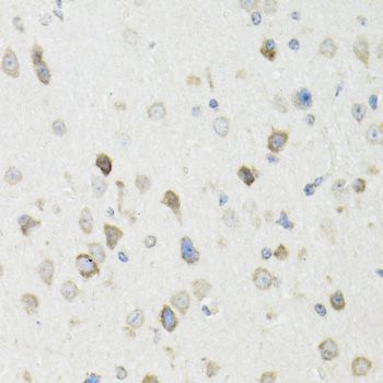 Vasohibin 1 / VASH1 Antibody - Immunohistochemistry of paraffin-embedded mouse brain using VASH1 antibody at dilution of 1:100 (40x lens).