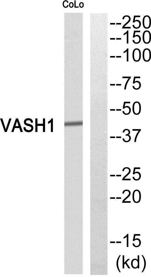 Vasohibin 1 / VASH1 Antibody - Western blot analysis of extracts from COLO205 cells, using VASH1 antibody.