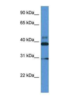 VASP Antibody - VASP antibody Western blot of Fetal Heart lysate. Antibody concentration 1 ug/ml.  This image was taken for the unconjugated form of this product. Other forms have not been tested.