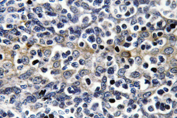 VASP Antibody - IHC of VASP (A232) pAb in paraffin-embedded human tonsil tissue.