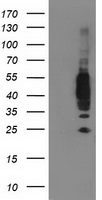 VASP Antibody - HEK293T cells were transfected with the pCMV6-ENTRY control (Left lane) or pCMV6-ENTRY VASP (Right lane) cDNA for 48 hrs and lysed. Equivalent amounts of cell lysates (5 ug per lane) were separated by SDS-PAGE and immunoblotted with anti-VASP.