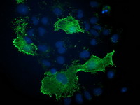 VASP Antibody - Anti-VASP mouse monoclonal antibody immunofluorescent staining of COS7 cells transiently transfected by pCMV6-ENTRY VASP.