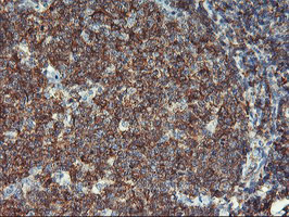 VASP Antibody - IHC of paraffin-embedded Human tonsil using anti-VASP mouse monoclonal antibody.