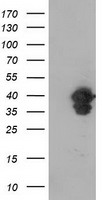 VASP Antibody - HEK293T cells were transfected with the pCMV6-ENTRY control (Left lane) or pCMV6-ENTRY VASP (Right lane) cDNA for 48 hrs and lysed. Equivalent amounts of cell lysates (5 ug per lane) were separated by SDS-PAGE and immunoblotted with anti-VASP.