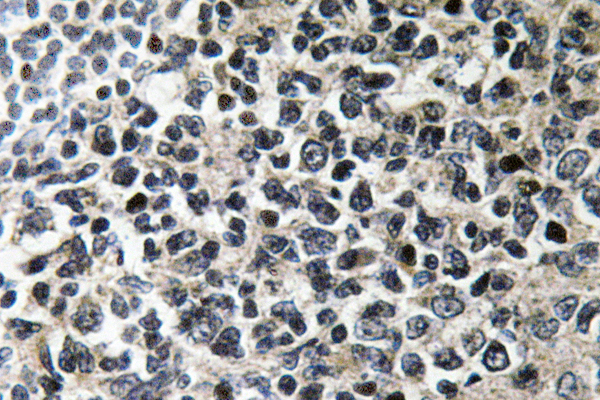 VASP Antibody - IHC of VASP (H151) pAb in paraffin-embedded human tonsil tissue.