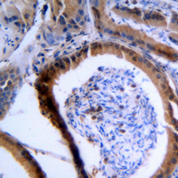 VASP Antibody - Immunohistochemical analysis of VASP staining in human tonsil formalin fixed paraffin embedded tissue section. The section was pre-treated using heat mediated antigen retrieval with sodium citrate buffer (pH 6.0). The section was then incubated with the antibody at room temperature and detected using an HRP conjugated compact polymer system. DAB was used as the chromogen. The section was then counterstained with hematoxylin and mounted with DPX.