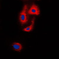 VASP Antibody - Immunofluorescent analysis of VASP staining in HepG2 cells. Formalin-fixed cells were permeabilized with 0.1% Triton X-100 in TBS for 5-10 minutes and blocked with 3% BSA-PBS for 30 minutes at room temperature. Cells were probed with the primary antibody in 3% BSA-PBS and incubated overnight at 4 C in a humidified chamber. Cells were washed with PBST and incubated with a DyLight 594-conjugated secondary antibody (red) in PBS at room temperature in the dark. DAPI was used to stain the cell nuclei (blue).
