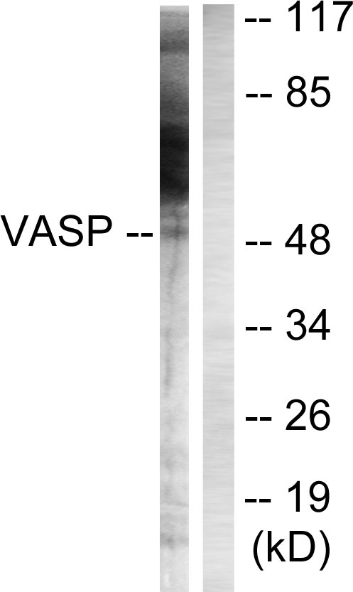VASP Antibody - Western blot of extracts from NIH/3T3 cells using VASP (Ab-156) antibody.